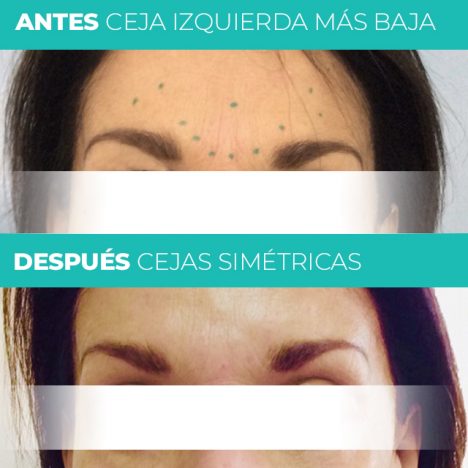 Alergias Test de Parche o Prueba Epicutánea Dermaclínica