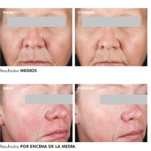 resultados-3337875742511