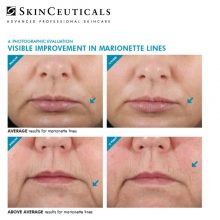 skinceuticals-ha-intensifier