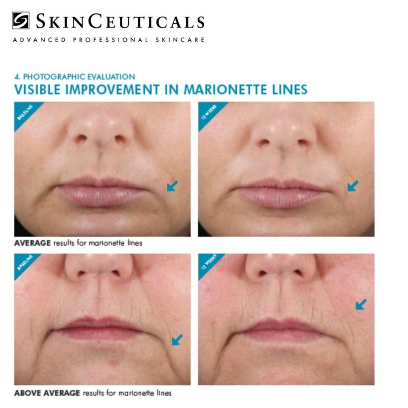 skinceuticals-ha-intensifier